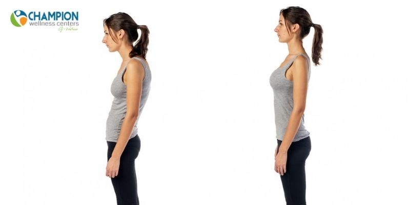  Chiropractic Adjustments for bad posture .