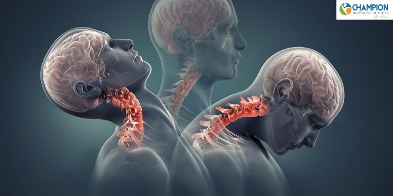 What Are The Symptoms Of Whiplash?