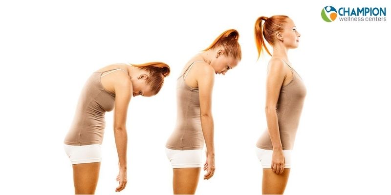 How can a chiropractor help you with improving your posture
